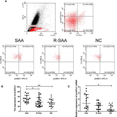 Upregulated Expression of Profilin1 on Dendritic Cells in Patients With <mark class="highlighted">Severe Aplastic Anemia</mark>